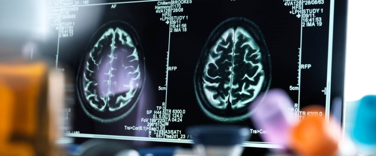 Neurologie pentru adulți, ArenaMed București