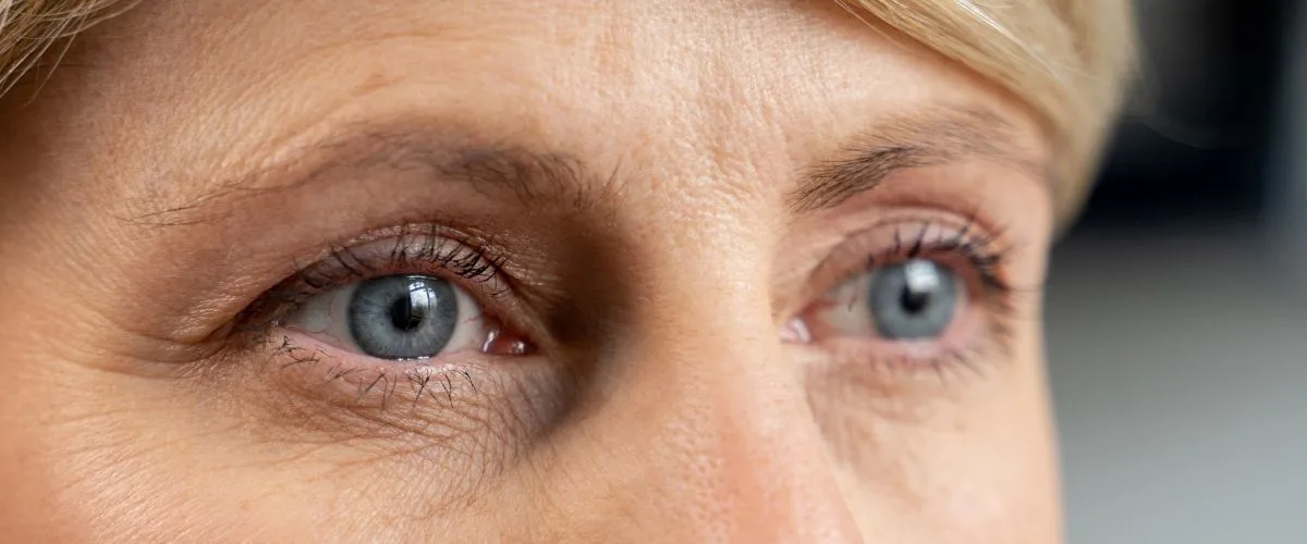 Ambliopia la Adulti: Cum Poate Afecta Vederea si Ce Poti Face